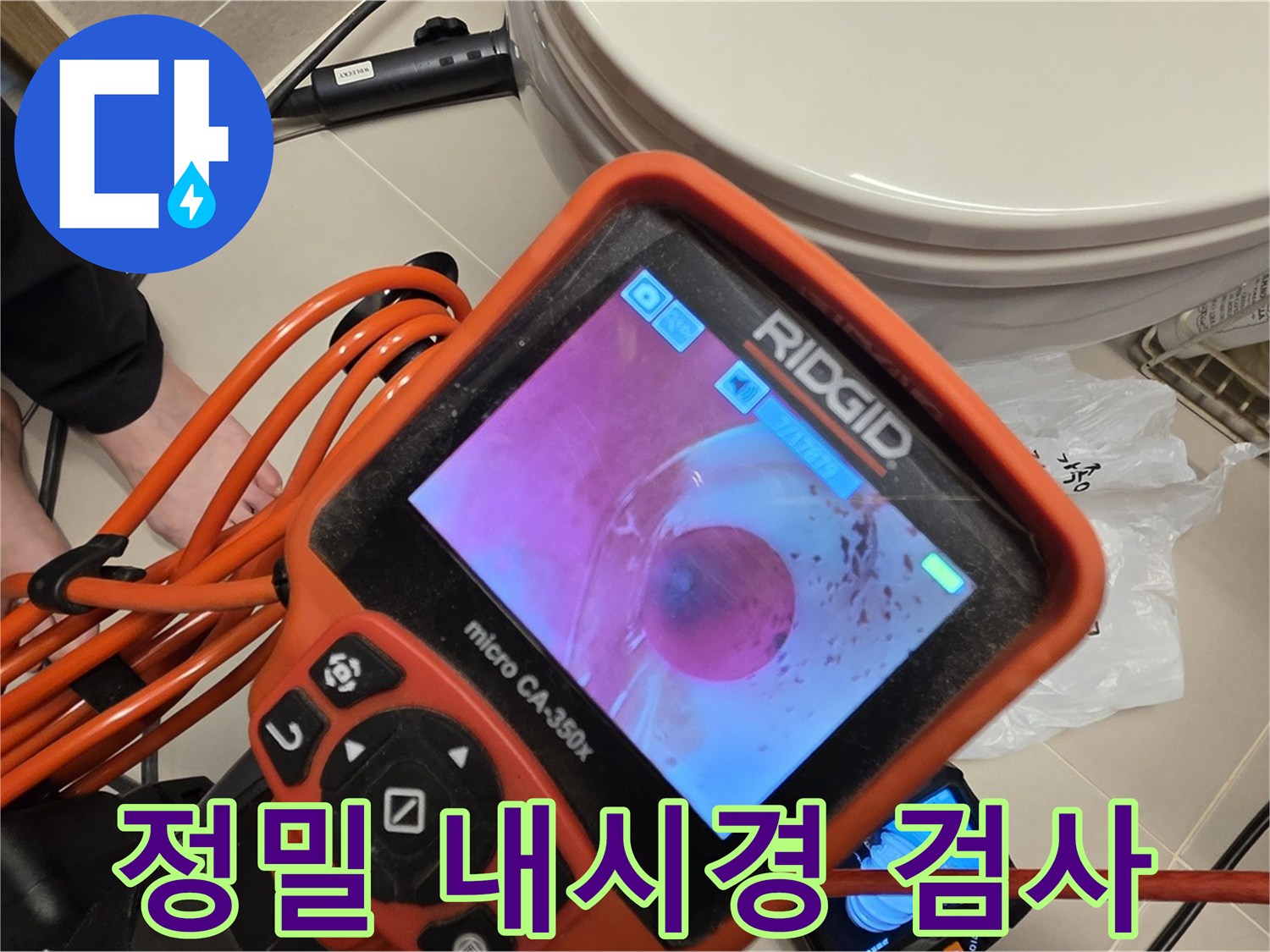 정밀 내시경 검사 - 작은 틈도 놓치지 않아요